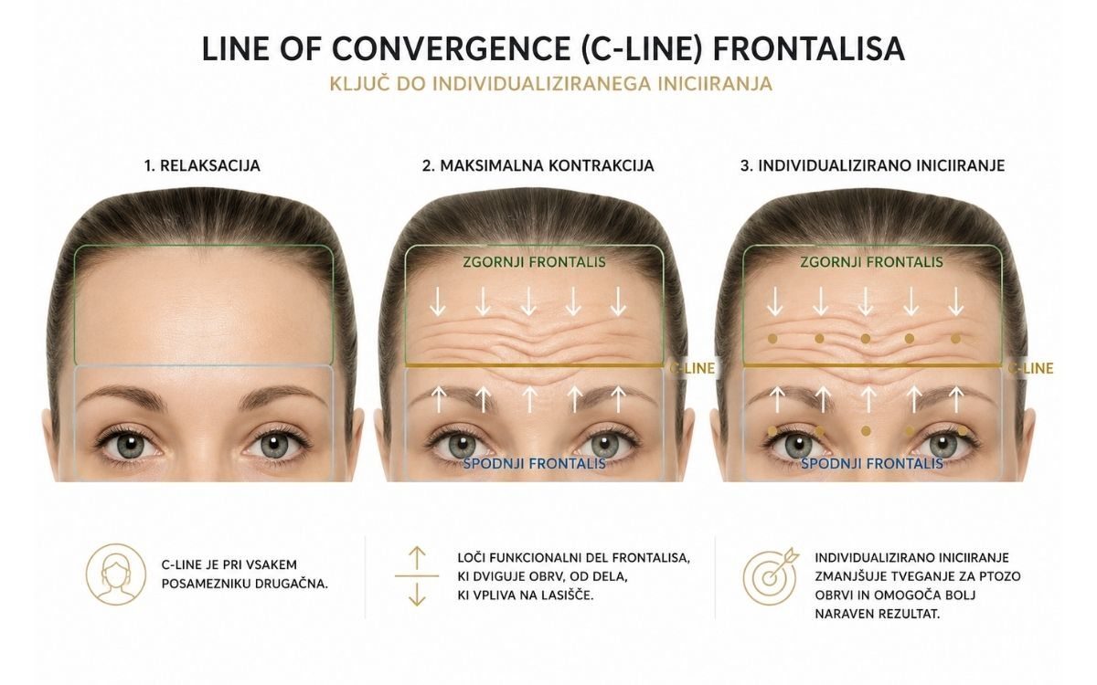 C-Line frontalisa — individualizirano injiciranje — Cotofana 2020