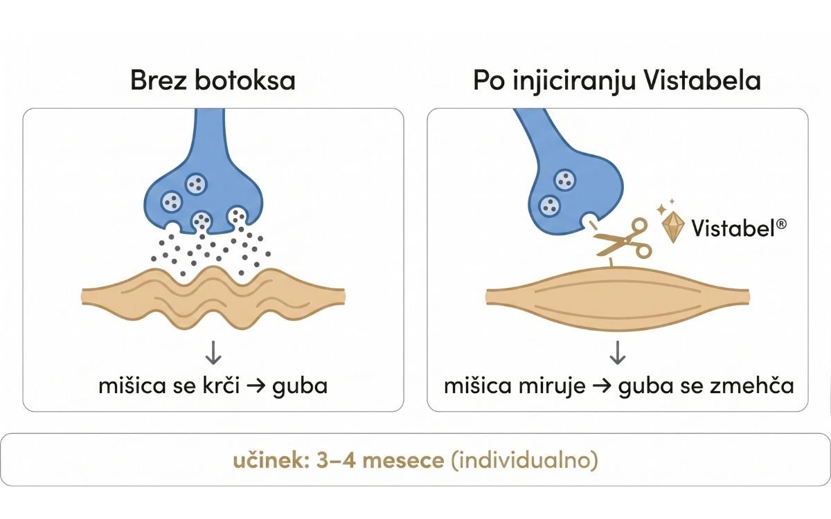 Diagram mehanizma delovanja botulin toksina SNAP-25 Vistabel